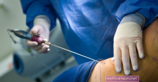 4 خيارات رئيسية لجراحة تجميل الثدي