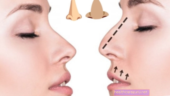 كيف تضبط أنفك بدون جراحة