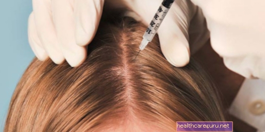ما هو الميزوثيرابي الشعري وكيف يتم ذلك