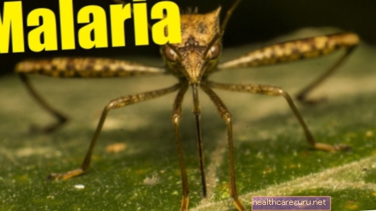 8 أعراض الملاريا الأولى
