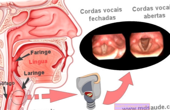 الحبال الصوتية الملتهبة: الأسباب والأعراض وكيفية العلاج