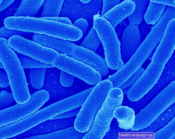 Lactobacillus acidophilus: ما هو وكيفية تناوله