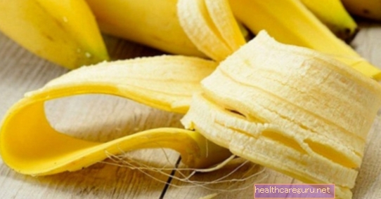8 فوائد رئيسية لقشر الموز وكيفية استخدامه
