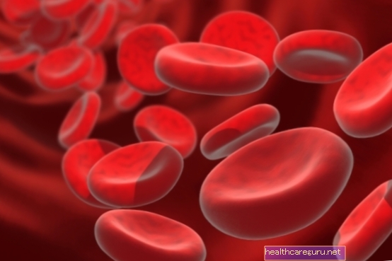 فقر الدم الانحلالي: ما هو وأهم الأعراض والعلاج