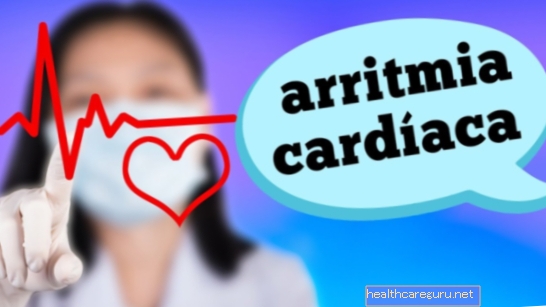 عدم انتظام ضربات القلب: ما هو ، الأعراض ، الأسباب والعلاج
