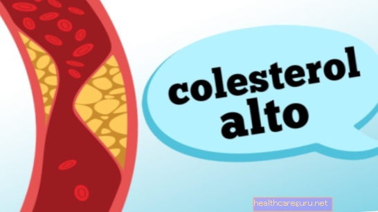 ارتفاع نسبة الكوليسترول - ماذا نأكل وما الذي يجب تجنبه