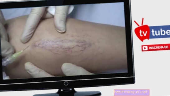 كيف يتم علاج سرطان الجلد