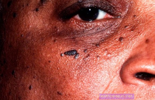 علاج أمراض الجلد
