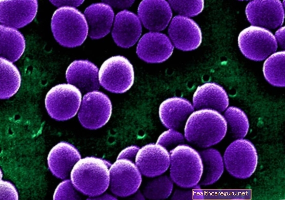 المكورات العنقودية (Staphylococcus): ما هي الأنواع الرئيسية والأعراض