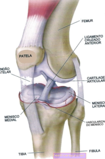 التهاب الأوتار في الركبة (الرضفة): الأعراض والعلاج