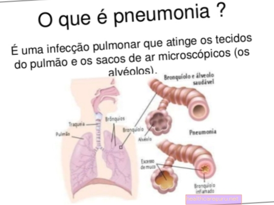 الالتهاب الرئوي التنفسي: ما هو ، الأعراض والعلاج