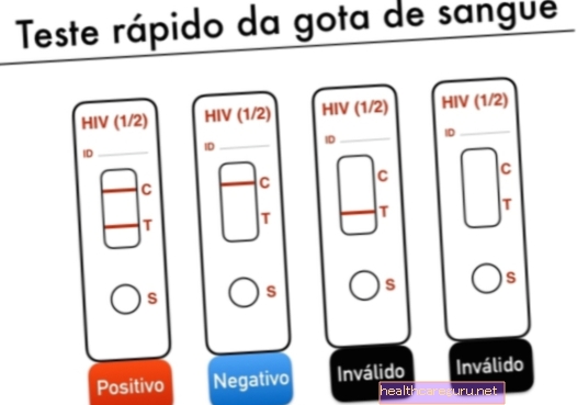 يحدد الاختبار السريع فيروس نقص المناعة البشرية في اللعاب والدم