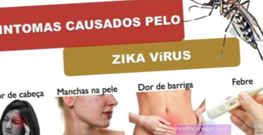 الأعراض التي يسببها فيروس زيكا